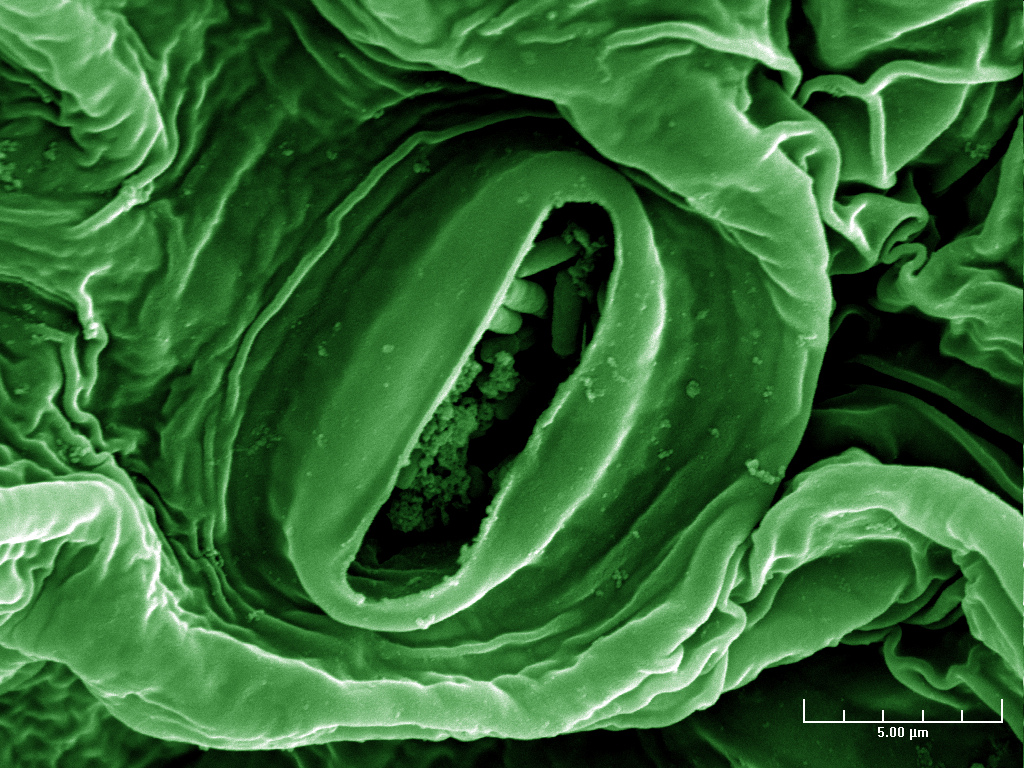 E. coli on romaine lettuce