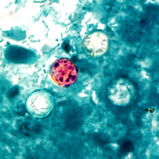 Cyclospora bacteria under a microscope